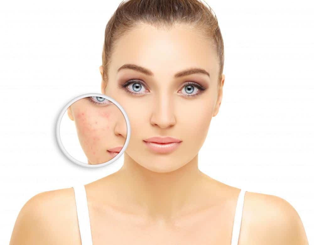 How To Take Of Your Skin? Causes And Solutions